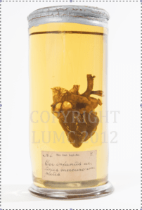 Heart injected with mercury and red wax, Eduard Sandifort, eighteenth century. Copyright LUMC 2012.